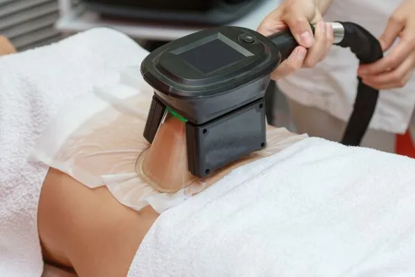 Image of person having fat freezing treatment to help weight gain Moss Side