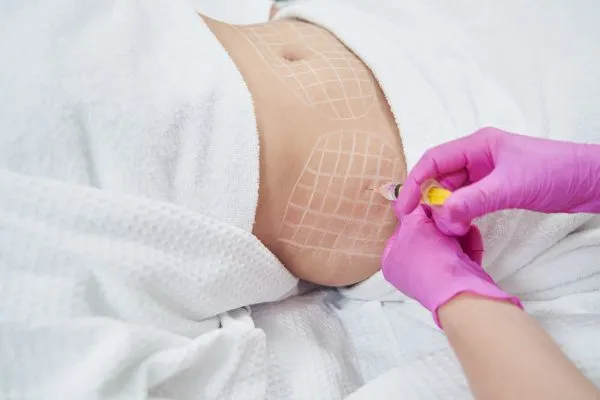image of fat dissolving injections on love handles to help combat weight gain Moss Side