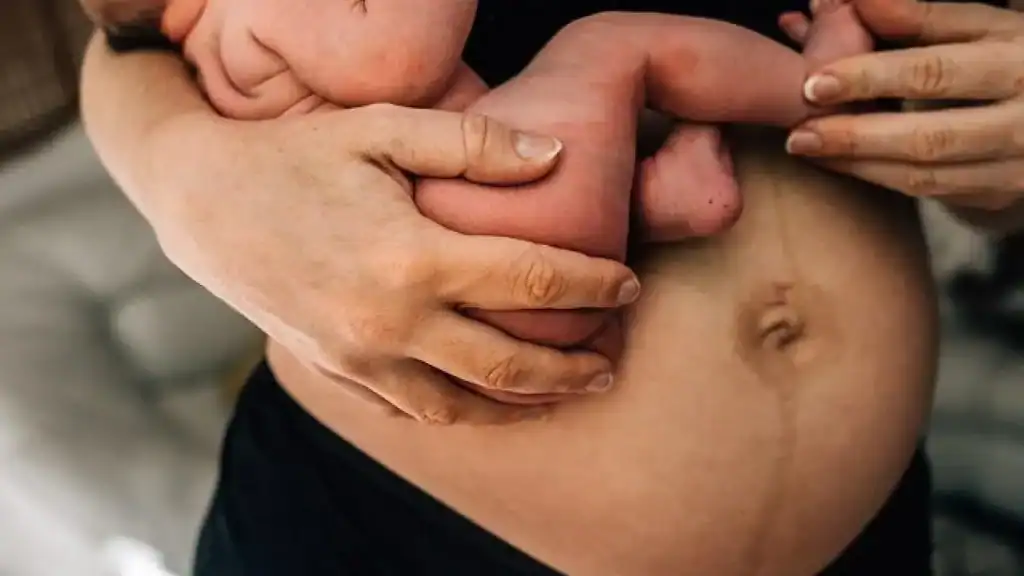 Why Is My Stomach Still Big After Pregnancy Moss Side?